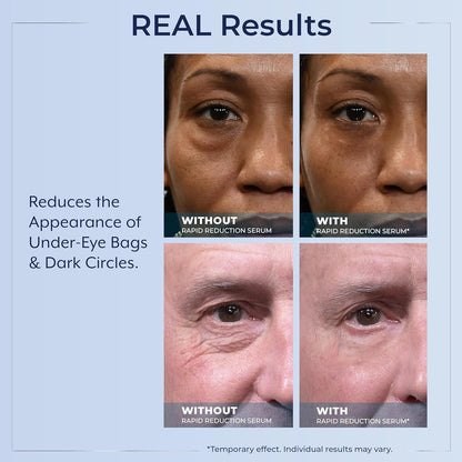Rapid Reduction Eye Serum