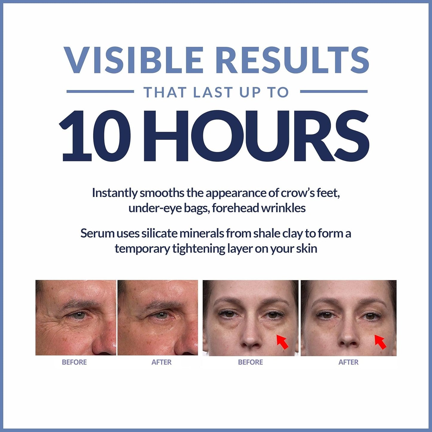 Rapid Reduction Eye Serum