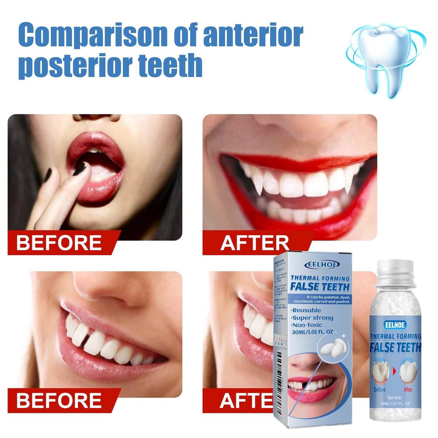 Eelhoe Temporary Tooth Repair: Perfect Solution for Gaps and Missing Teeth!✨